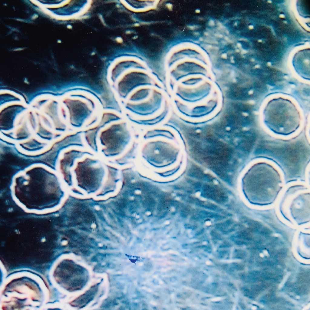 Dunkelfeldtherapie Heilpraktikerin Eva Stamm Köln